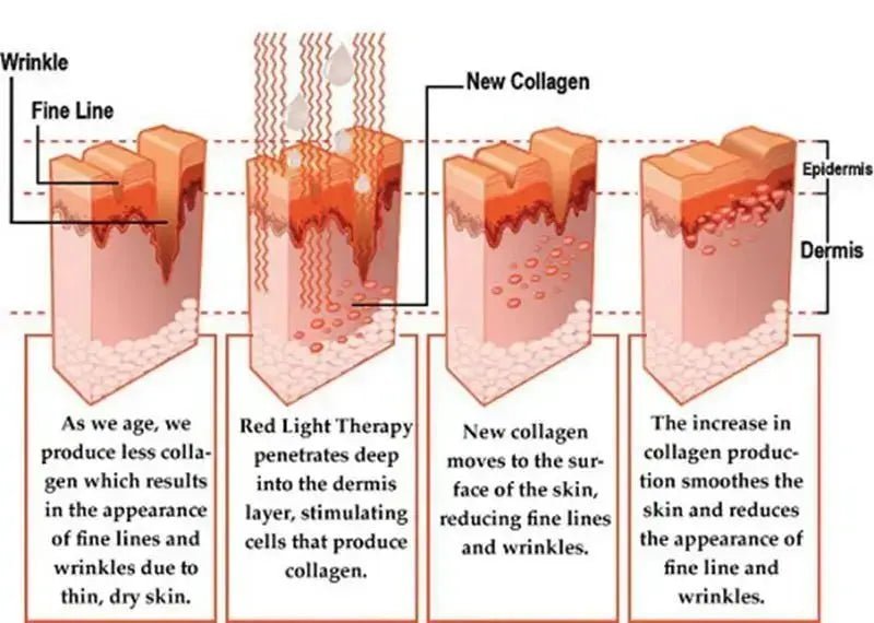 Red LED Light Therapy for Skin Rejuvenation & Pain Relief - Futures ETC red light therapy